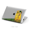 The Kiss, Clear Hard Case, Gustav Klimt, Personalized Name