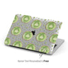Watercolour Kiwi fruit, Clear Macbook Hard Case