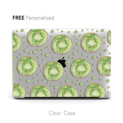 Watercolour Kiwi fruit, Clear Macbook Hard Case - MinimalGadget